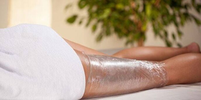 sveobuhvatno mršavljenje kod kuće